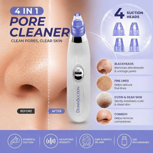 4-in-1 Pore Cleaner – Blackhead & Facial Suction Device